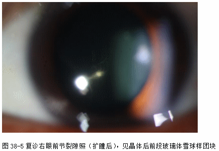 ZY016_203_2.gif